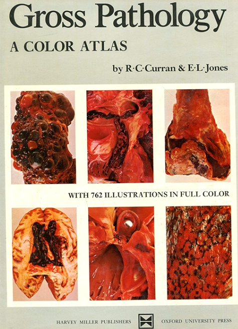 Gross Pathology: A Colour Atlas